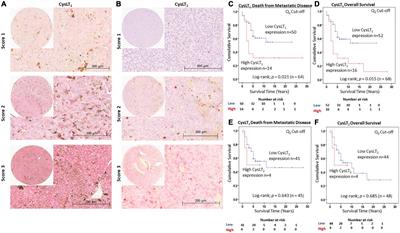 1,4-dihydroxy quininib modulates the secretome of uveal melanoma tumour explants and a marker of oxidative phosphorylation in a metastatic xenograft model